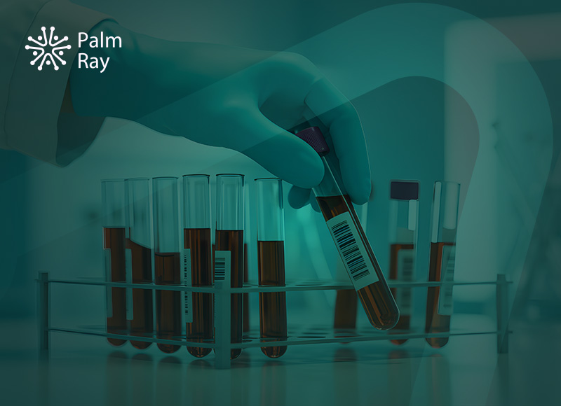 Blood test