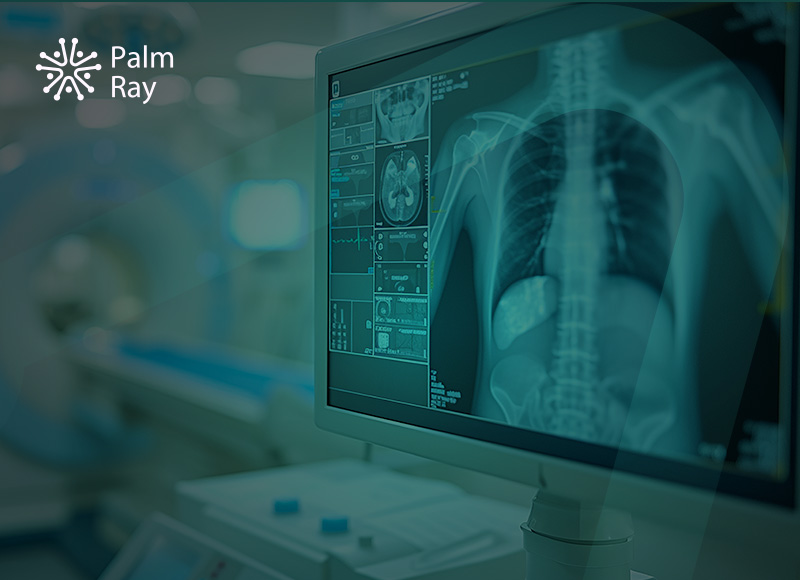 X-Ray